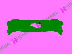 TAMPON BAKALİTİ ÖN ÜST PEUGEOT 301 2012-2016